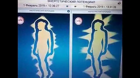 КФС Браслет Фитнес. Результат.